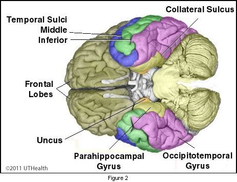 Middle Temporal Sulcus