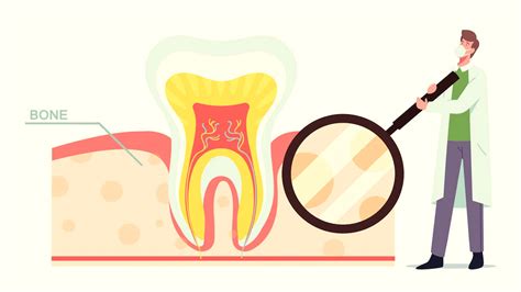 Tooth Root Resorption: Signs Of Damaged Teeth Roots You Should Never ...