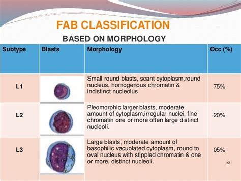 Acute lymphoblastic leukemia (ALL) dr arun haldia