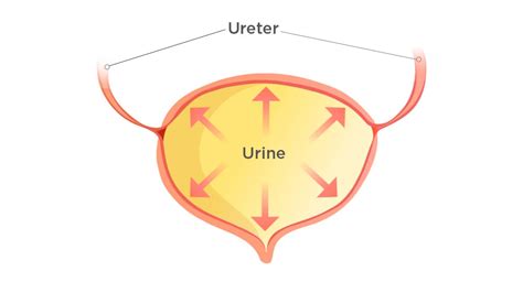 Women and LUTS: Atonic Bladder