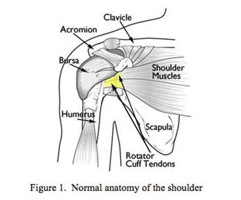 Shoulder Impingement Syndrome Los Angeles | Shoulder Pain Beverly Hills