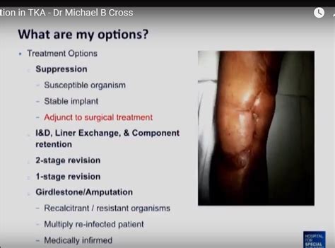 Suppression of Chronic Infection in Total Knee Replacement — OrthopaedicPrinciples.com