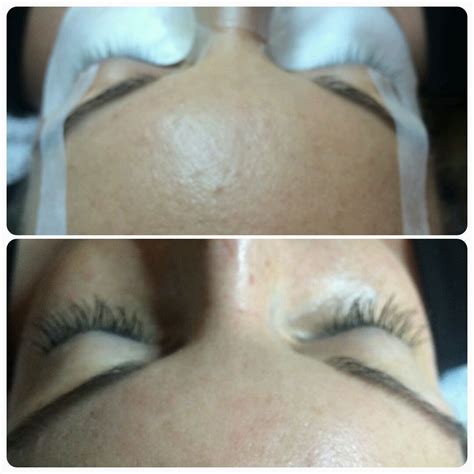 Eyelash Extensions, Lash Extensions, Before/After | Skin care ...