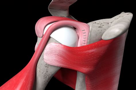 Returning to Sports and Activities After a Labral Tear | Spine ...