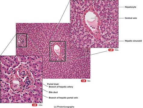 Cholangiocarcinoma - Bile Duct Cancer - Causes, Symptoms, Treatment