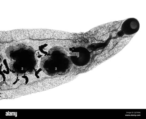 Parasitic worm microscope Black and White Stock Photos & Images - Alamy