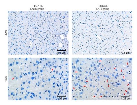 TUNEL staining for detecting apoptosis. (a) Typical photomicrographs ...