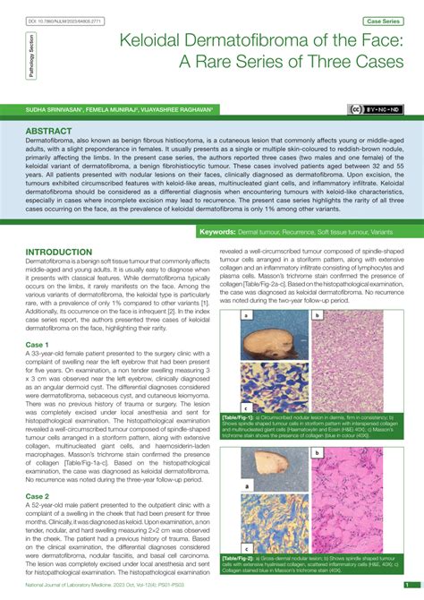 (PDF) Keloidal Dermatofibroma of the Face: A Rare Series of Three Cases