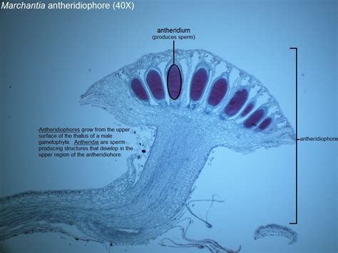 H Marchantia Antheridia 40X