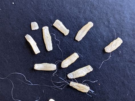 The wrong kind of worms – Tapeworms :( - Bug News