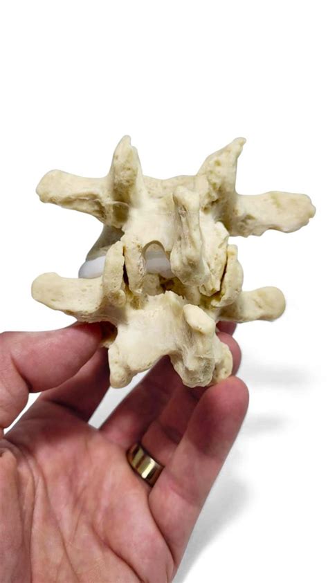 Hemilaminectomy Lumbar Model