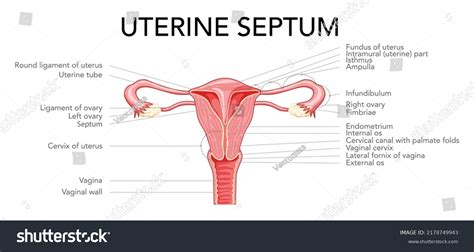 Uterine septum septate uterus Female - Royalty Free Stock Vector ...