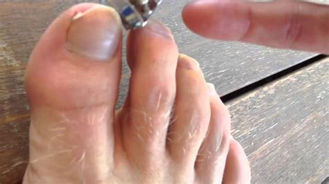 The Bi Annual cutting of the toe nails - YouTube