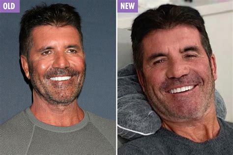 Simon Cowell looks back to his best as he poses with dentist after getting 'more natural ...