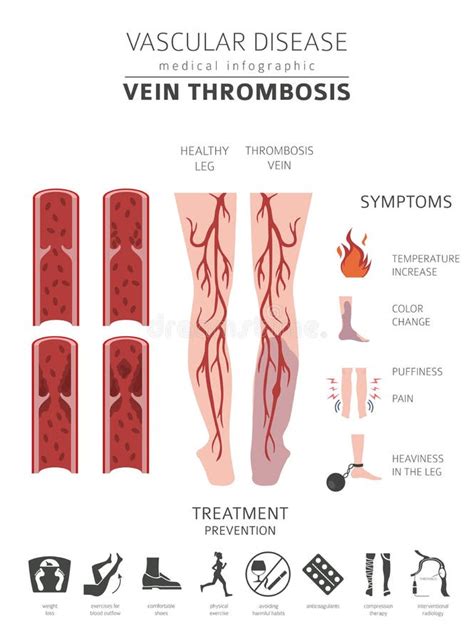 Doenças Vasculares Sintomas Da Trombose Da Veia, Grupo Do ícone Do ...