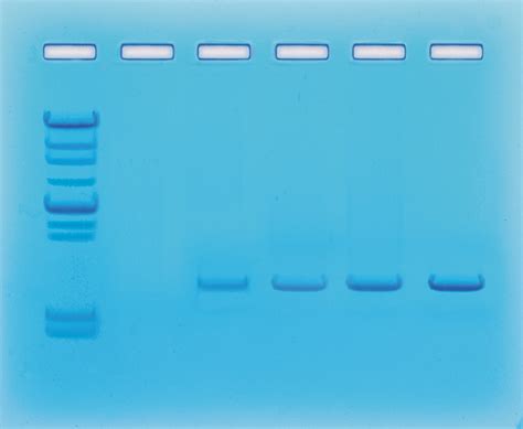 Amplification of DNA by PCR » BioTek