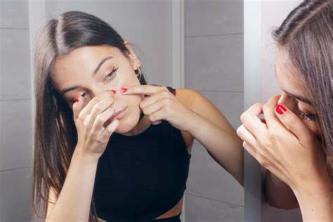 The Obsession With Pimple Popping & Is it Bad? - Benzac AU