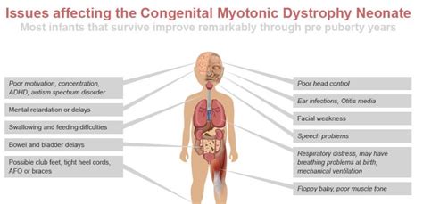 Myotonic Muscular Dystrophy - Life Expectancy, Symptoms, Treatment