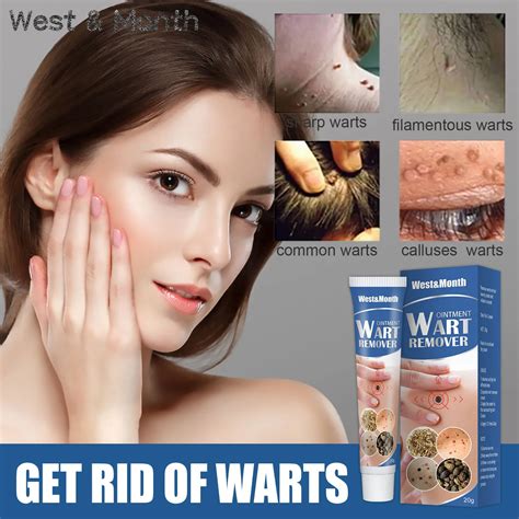 1box 60g New Upgrade Wart Cream Treat Skin Tag Mole Calluses Acne ...