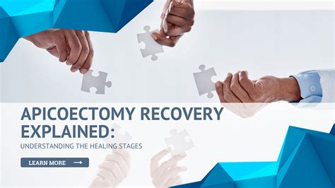 Apicoectomy Healing Stages: Insights into Your Recovery Journey