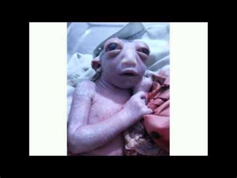 Alien Baby born in Uttar Pradesh , India | Baby girl born, Baby born, Baby pictures