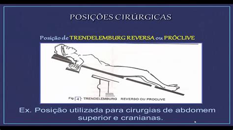 Posições cirúrgicas - YouTube