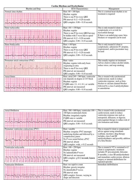 Ekg Interpretation in 2020 | Ekg interpretation, Nurse study notes, Ekg interpretation cheat sheets