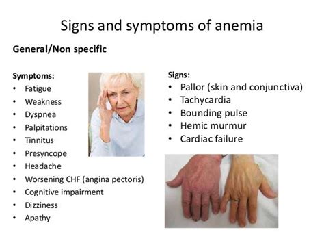 Anemia in elderly