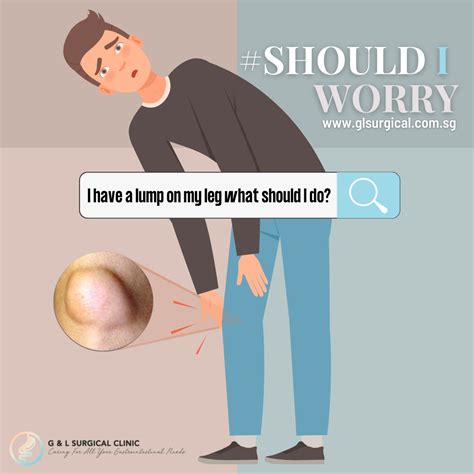 #ShouldIWorry - Lump on Leg - Dr Ganesh Ramalingam