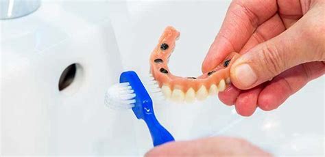 How to Clean Dentures: Oral Hygiene Tips to Keep Your Dentures Clean