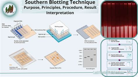 Southern Blotting: Purpose, Principles, Procedure, Result Interpretation and more | Lab Tests Guide