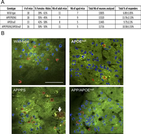 Opposing Roles of apolipoprotein E in aging and neurodegeneration | Life Science Alliance