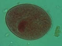 9 Balantidium coli ideas | cysts, medical laboratory, oral