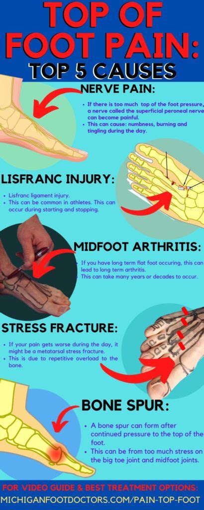 Exostosis On Top Of Foot