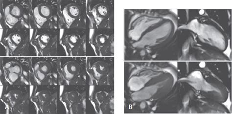 SECTION II CARDIAC IMAGING | Radiology Key