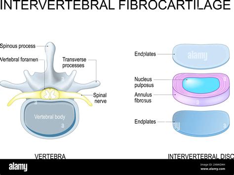 Intervertebral disc structure from Nucleus pulposus and Annulus fibrosus to Endplates. Vertebra ...