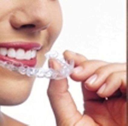 Invisible Retainer - Retainers - Before and After Gallery