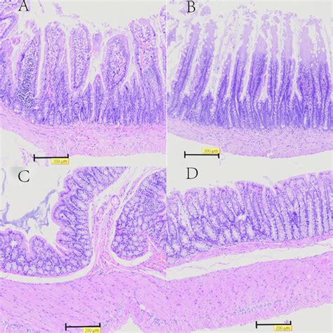 Representative histology of the ileum and colon with HE stain in T2D ...