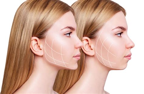 Chin & Jawline Filler for Defined Contours - Skinox Aesthetics