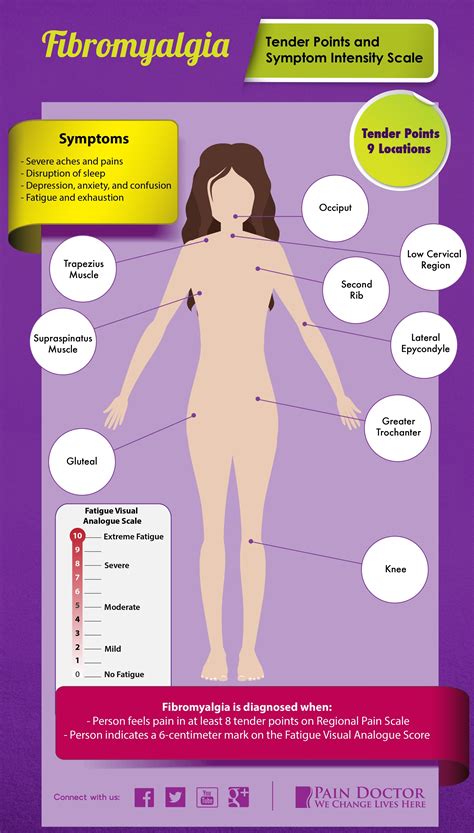 Fibromyalgia Tender Points And The Symptom Intensity Scale