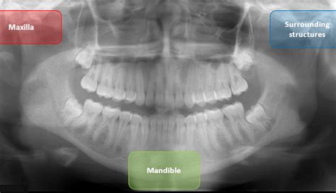 panoramic radiograph | E-Gallery | University of Nebraska Medical Center