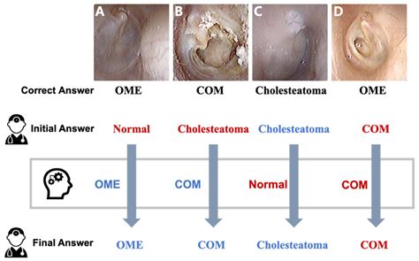 JCM | Free Full-Text | An Assistive Role of a Machine Learning Network in Diagnosis of Middle ...