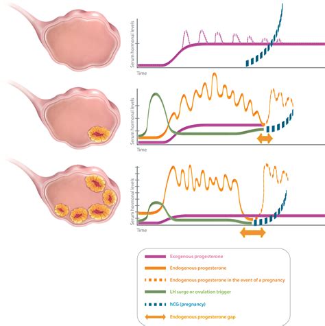 Frontiers | Low Luteal Serum Progesterone Levels Are Associated With Lower Ongoing Pregnancy and ...