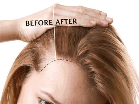 Collagen For Hair - Are You Prepared For A Good Thing? - Lewigs