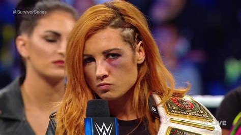 Becky Lynch Survivor Series Replacement Confirmed - WrestleTalk