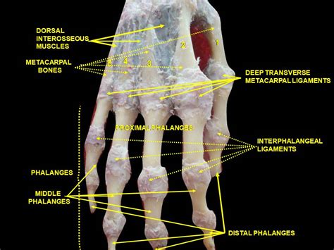 Hand Bones; Bones of Hand