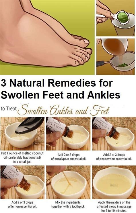 3 Natural Remedies for Swollen Feet and Ankles Try some of these ...