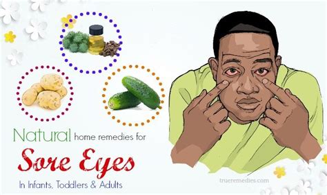 19 Home Remedies For Sore Eyes In Infants, Toddlers & Adults