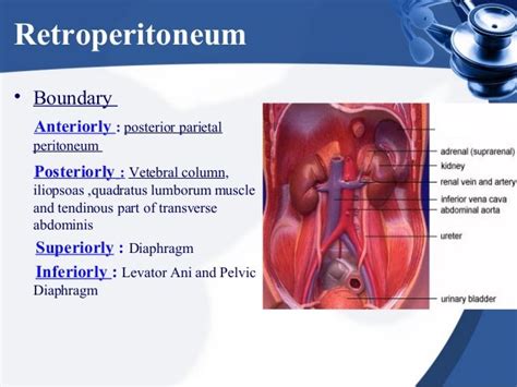 Retroperitoneal mass