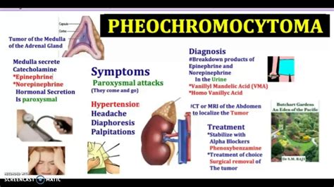 PHEOCHROMOCYTOMA in 3 mintes - YouTube